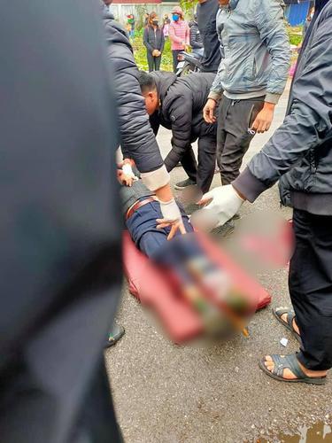 Điều khiển xe máy qua đường không quan sát, người đàn ông bị xe khách tông trúng chấn thương nặng đi cấp cứu
